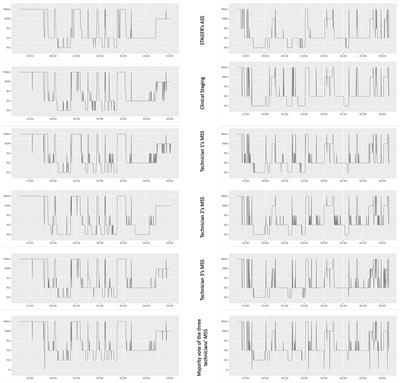 Enhanced sleep staging with artificial intelligence: a validation study of new software for sleep scoring
